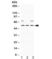 ABAT Antibody