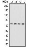 Polyclonal Rabbit anti-Human RELA / NFKB p65 Antibody (Internal, IHC, IF, WB)