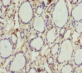 Polyclonal Rabbit anti-Human AK1 / Adenylate Kinase 1 Antibody (IHC, WB)