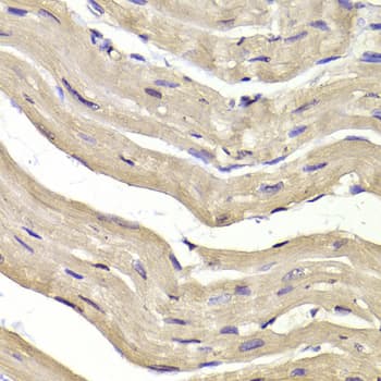 Polyclonal Rabbit anti-Human COPS3 / CSN3 Antibody (IHC, IF, WB)