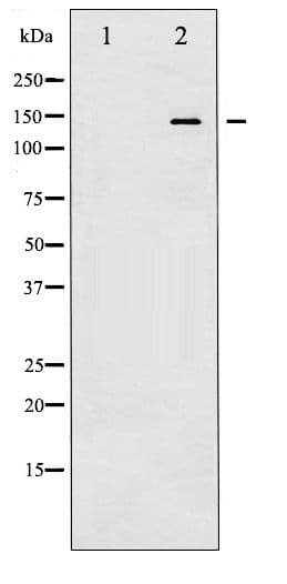 CASR/Calcium Sensing Receptor Antibody (phospho-Thr888)