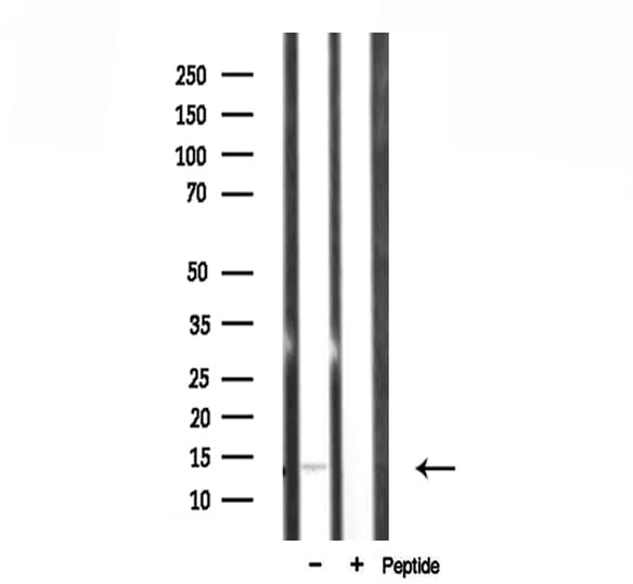 RPL34 / Ribosomal Protein L34 Antibody