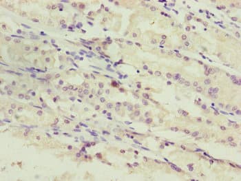 PPP2R3C Antibody