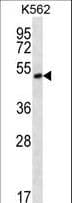 Polyclonal Rabbit anti-Human MORN1 Antibody (aa29-58, IHC, WB)