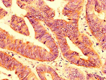 PLXNB1 / Plexin-B1 Antibody