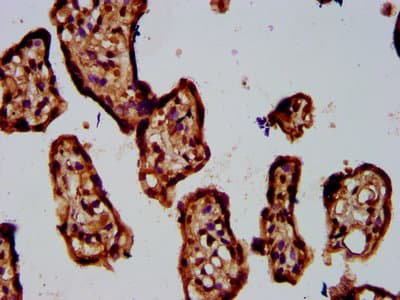 Polyclonal Rabbit anti-Human ADAMTS5 Antibody (IHC)