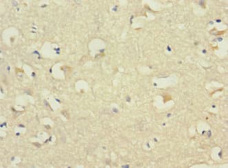 Polyclonal Rabbit anti-Human CDH10 / Cadherin 10 Antibody (aa20-260, IHC)
