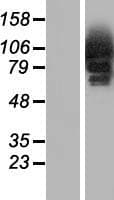 CYLD Protein (Over-Expression Lysate Myc-DDK (Flag))