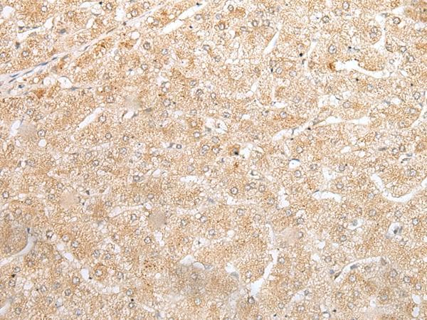 NUDT19 Antibody