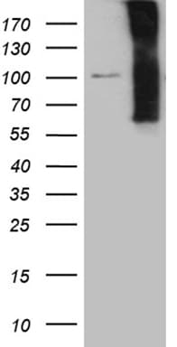 Monoclonal Mouse anti-Human NOS1AP / CAPON Antibody (clone OTI10F8, aa1-196, WB)