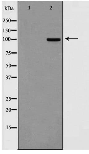 Polyclonal Rabbit anti-Human DLGAP1 Antibody (IF, WB)