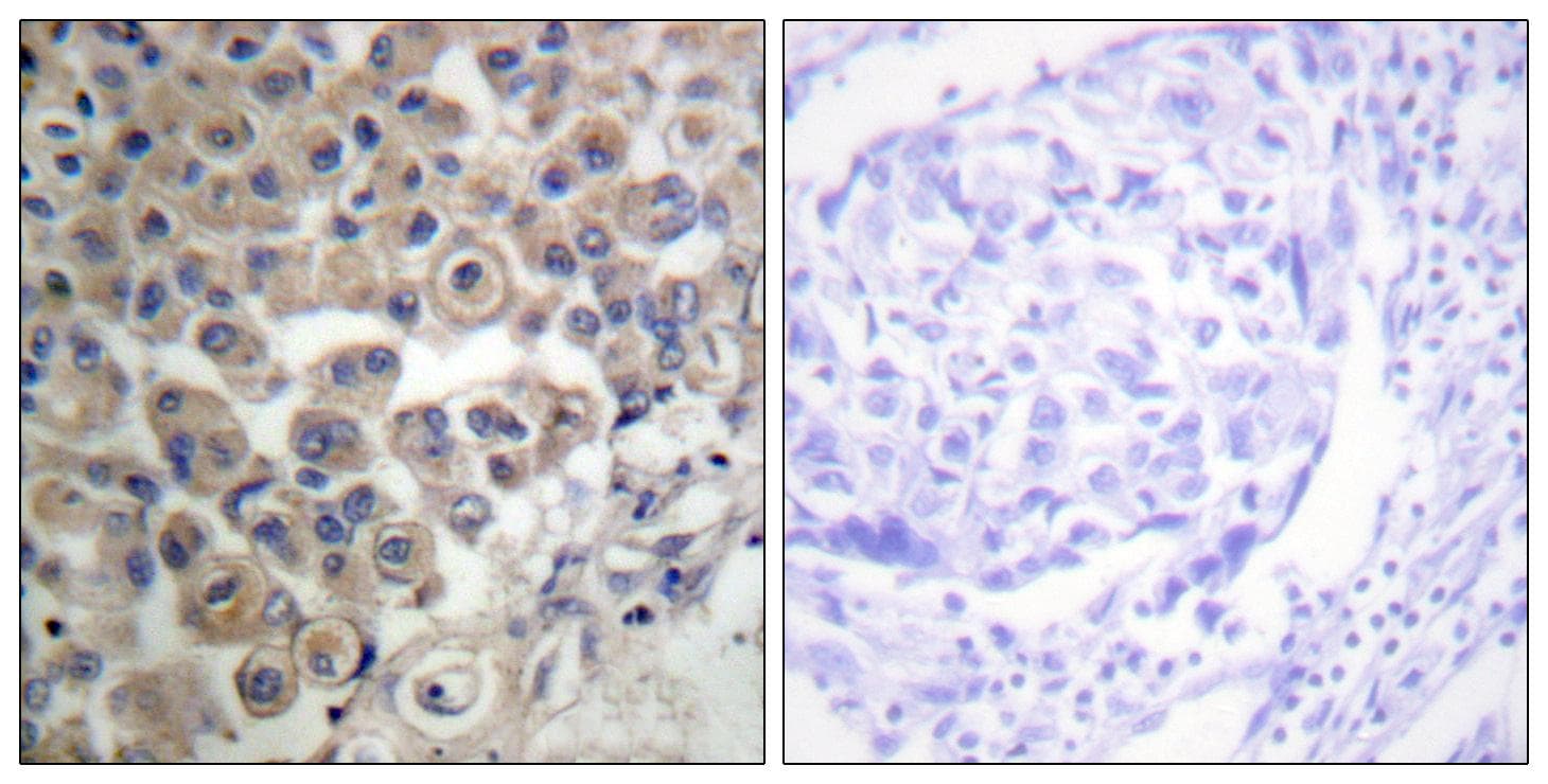 PLCB3 Antibody