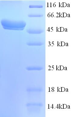 Human GALNS / Chondroitinase Protein (Recombinant His)