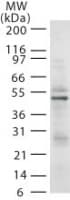 RAD18 Antibody (aa402-414, clone 79B1048.1)
