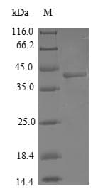Human COX7A2L Protein (Recombinant GST, N-terminus)