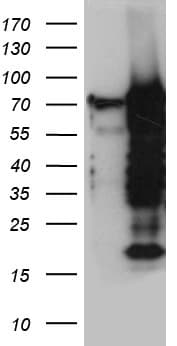 ELL / MEN Antibody (aa302-621, clone OTI3A8)