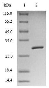 Human BIRC5 / Survivin Protein (Recombinant 6His-SUMO, N-terminus)