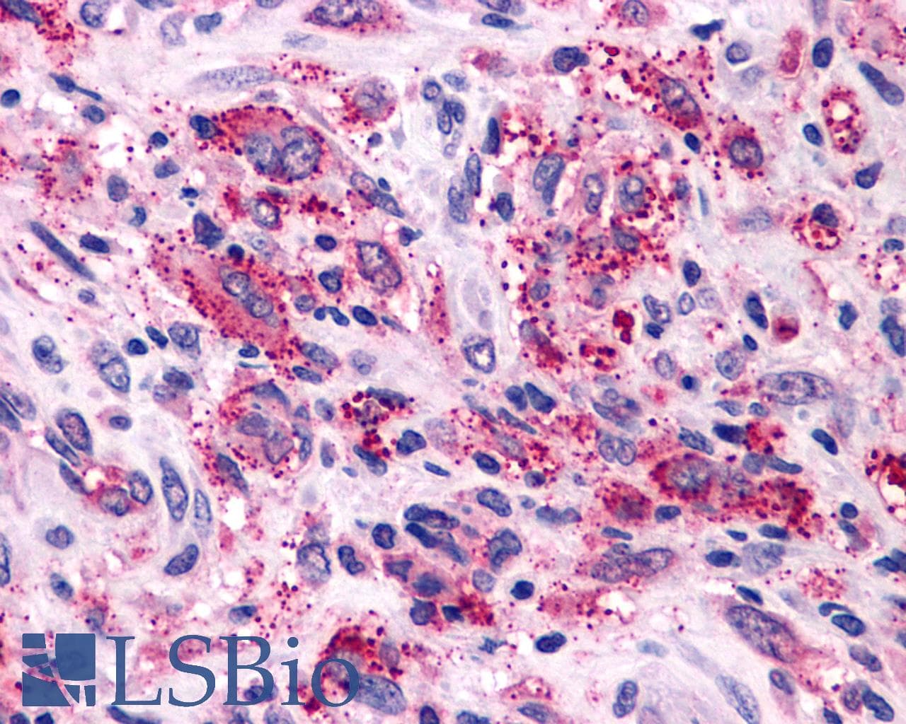 IHC-plus™ Polyclonal Rabbit anti-Human NPY1R Antibody (Extracellular Domain, IHC)