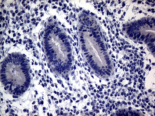CFI / Complement Factor I Antibody (aa340-583, clone OTI7C8)