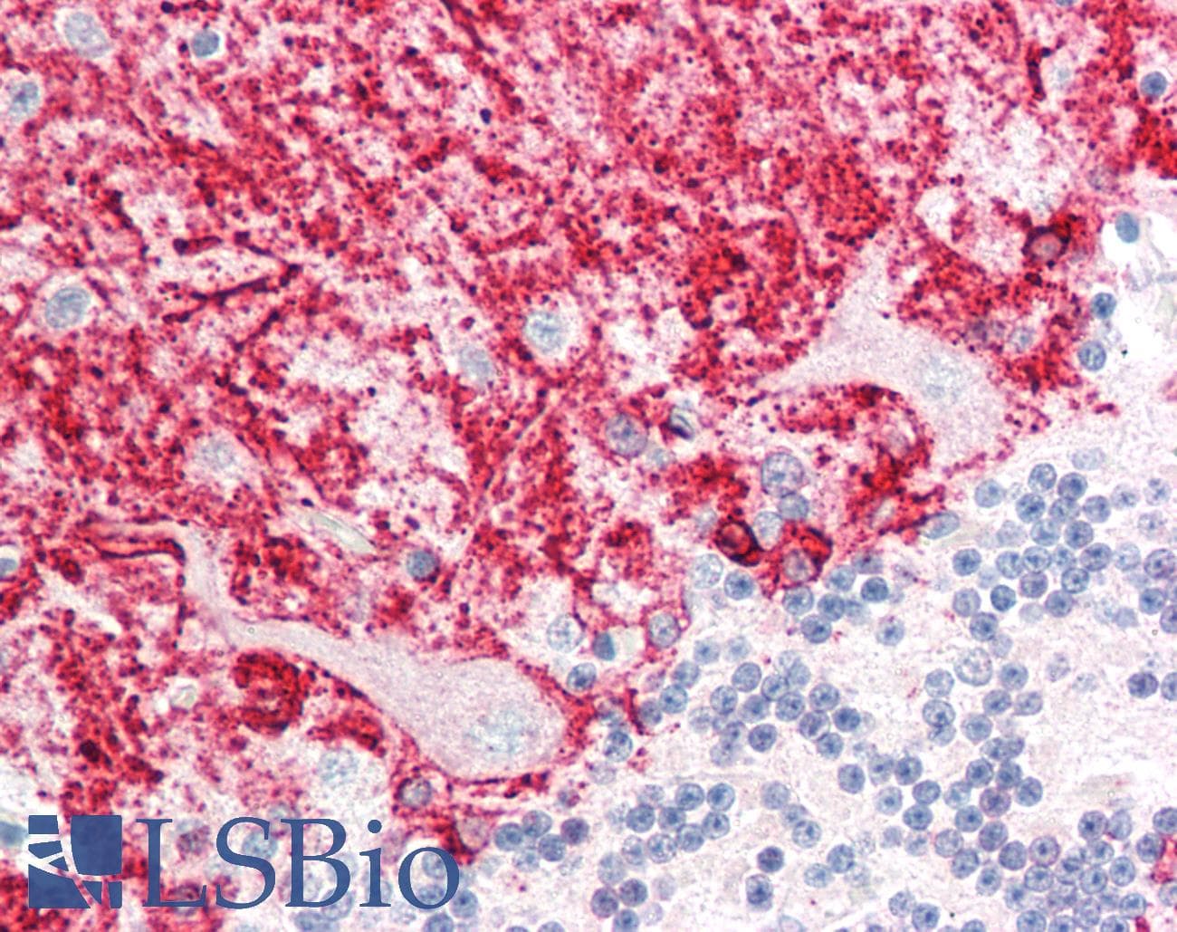 Polyclonal Rabbit anti-Human RCAN1 / DSCR1 Antibody (N-Terminus, IHC, WB)