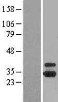 OTUB1 / OTU1 Protein (Over-Expression Lysate Myc-DDK (Flag))