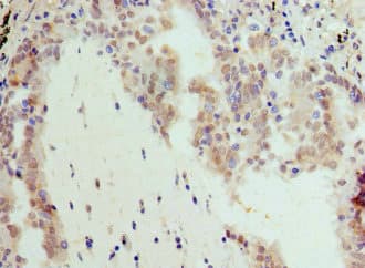 BRD7 Antibody