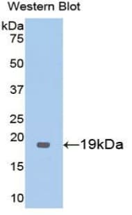 THBD / CD141 / Thrombomodulin Antibody (aa325-481, Biotin)