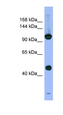 PSMD1 Antibody (aa107-156)
