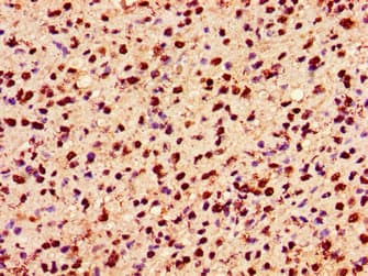 HIST1H2AI Antibody