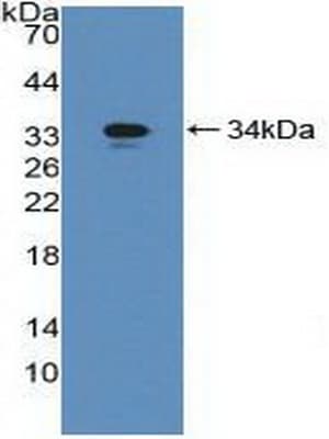 GGT1 / GGT Antibody (aa296-537)