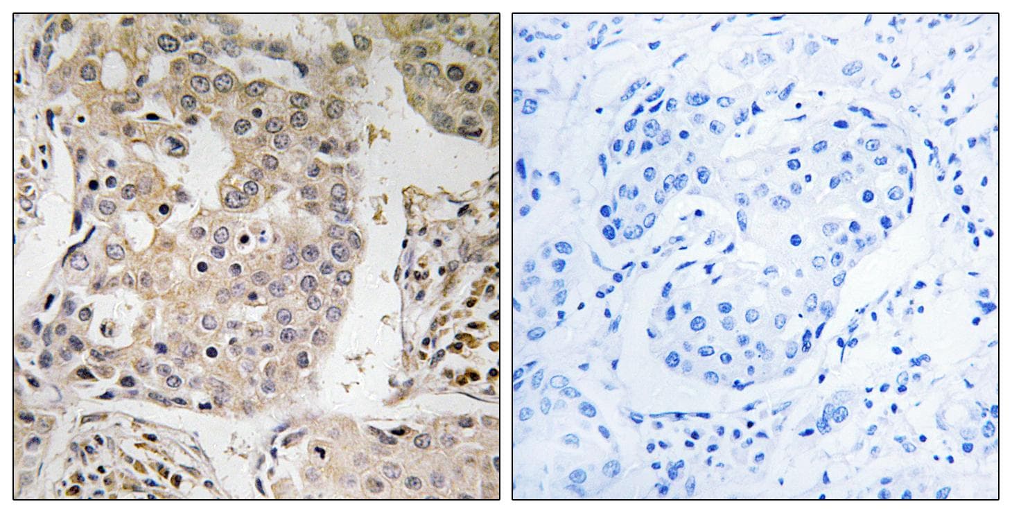 MRPL41 / PIG3 / BMRP Antibody