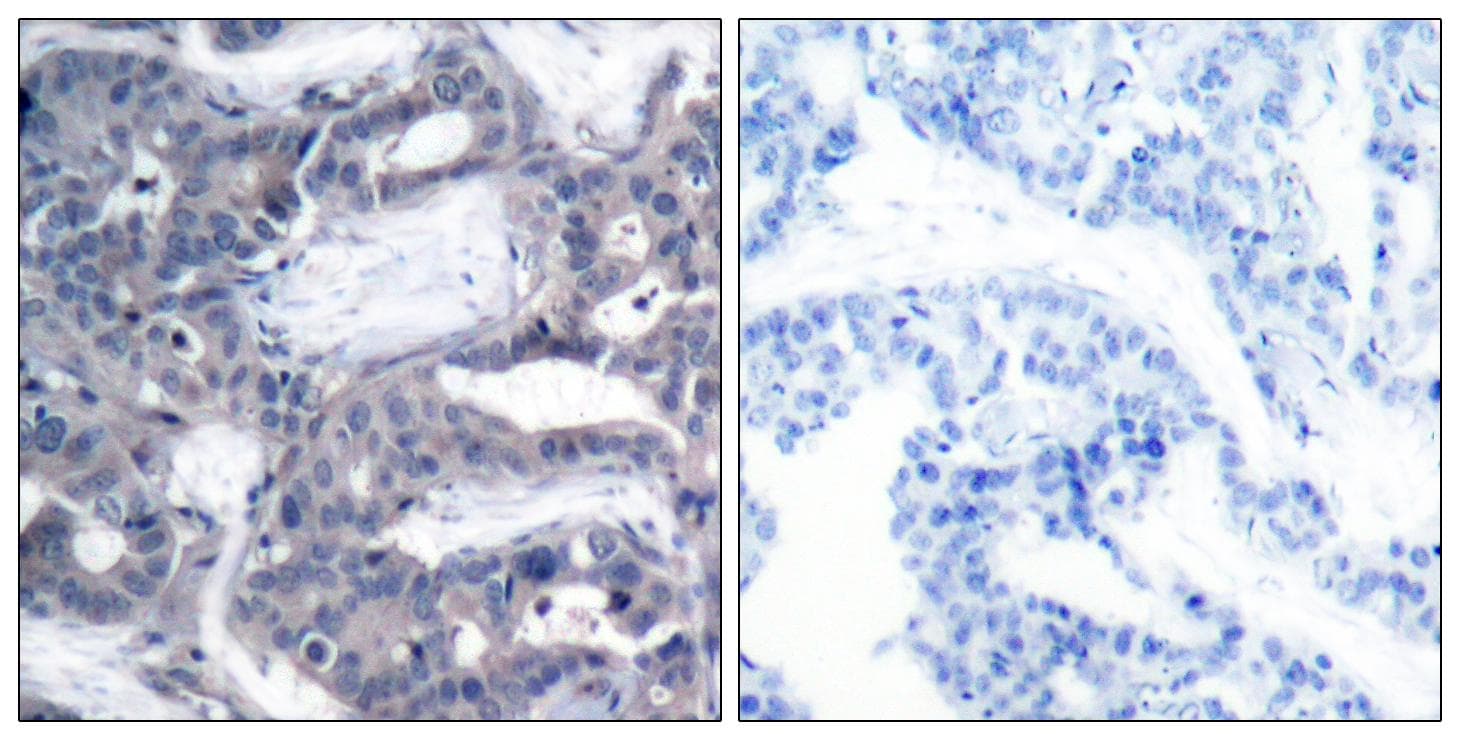 MAP2K2 / MKK2 / MEK2 Antibody (phospho-Thr394)
