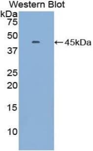 GOLM1 / GP73 / GOLPH2 Antibody (aa119-223)