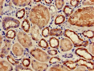 GPX4 / MCSP Antibody