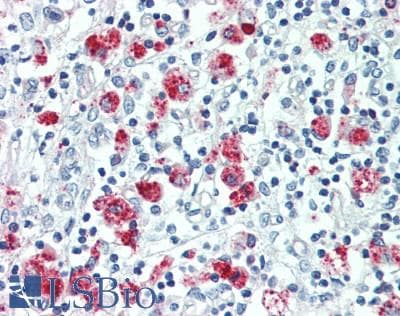 IHC-plus™ Polyclonal Rabbit anti-Human FOLR3 Antibody (aa24-53, IHC, WB)