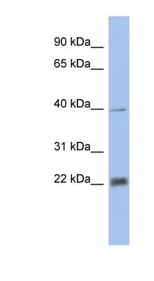 Polyclonal Rabbit anti-Human PSMA4 Antibody (aa35-84, WB)