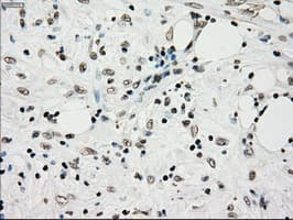 TYRO3 Antibody (clone OTI5B4)