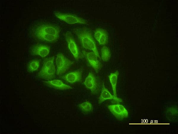 GMF Beta / GMFB Antibody (clone 2G12-2A2)