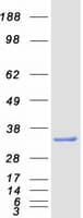 Human CINP Protein (Recombinant Myc-DDK (Flag))