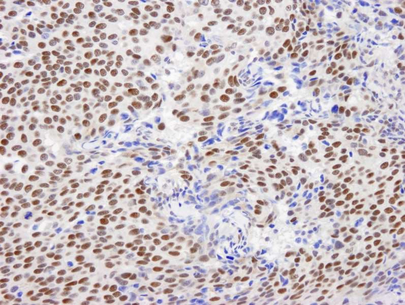 Polyclonal Rabbit anti-Human GTF2I / TFII I Antibody (aa950-C-term, IHC, IF)