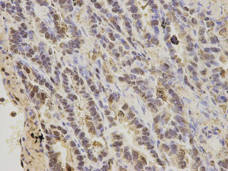 IHC-plus™ Calgizzarin / S100A11 Antibody