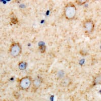 Polyclonal Rabbit anti-Human DARS Antibody (IHC, WB)