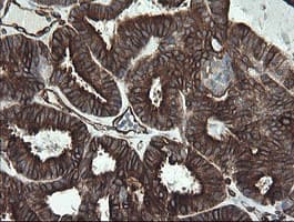 TMEM173 / STING Antibody (clone 4.00E+12, Carrier-free)