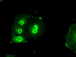 Monoclonal Mouse anti-Human BIRC7 / Livin Antibody (clone OTI1B10, IF, WB)