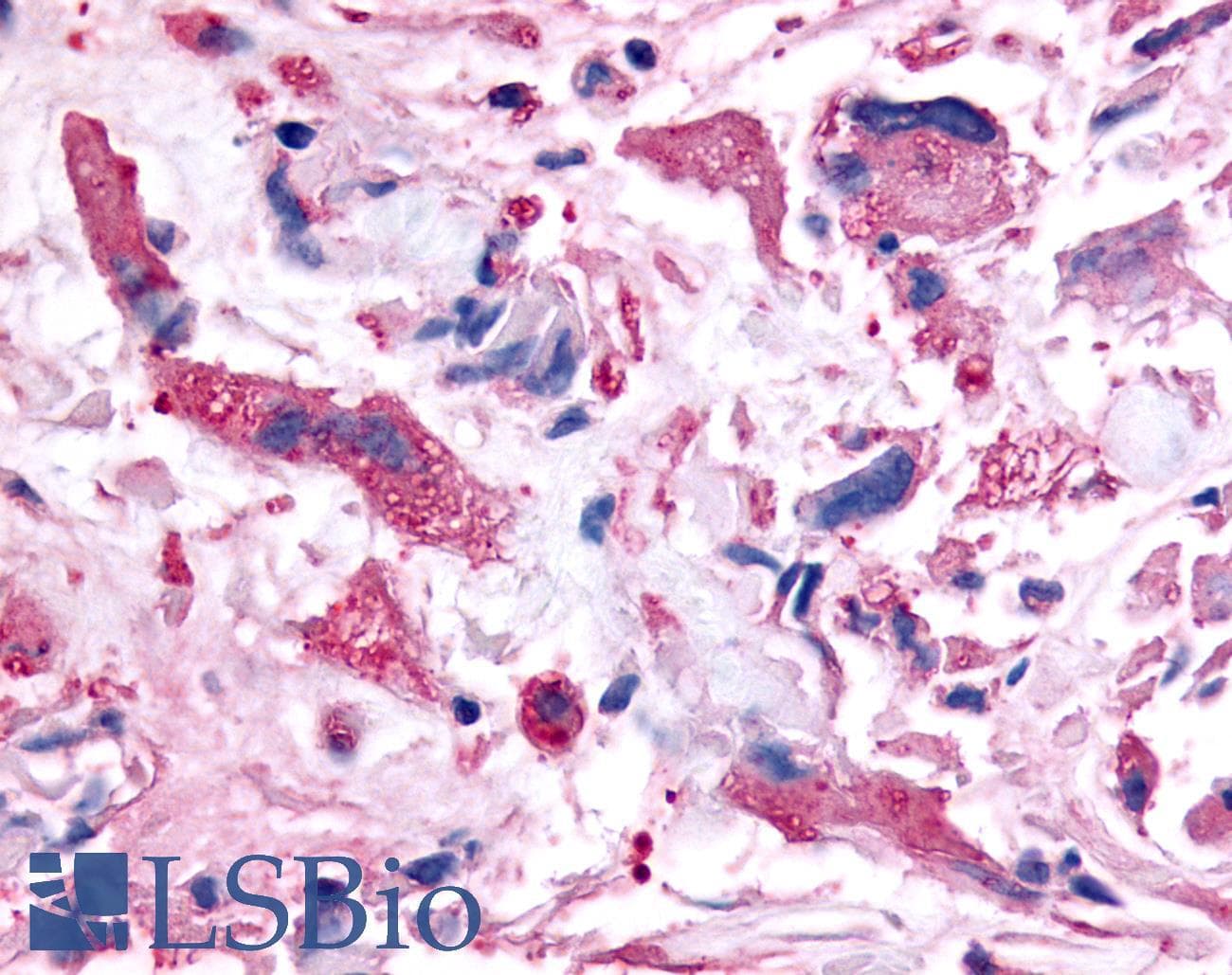 PathPlus™ PAK6 Antibody (Linker Domain)