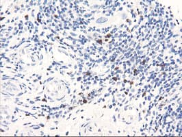 SERPINB2 / PAI-2 Antibody (clone OTI1E3, Carrier-free)