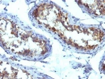 Alkaline Phosphatase Antibody (clone ALPL/597)