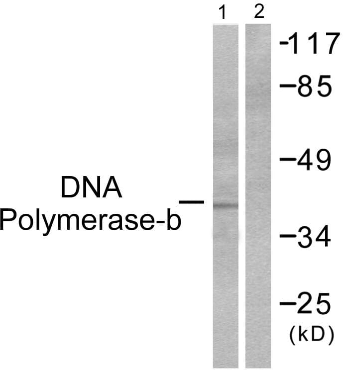 POLB / DNA Polymerase Beta Antibody