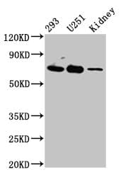 Polyclonal Rabbit anti-Human Eomesodermin / EOMES Antibody (IHC, WB)