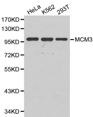 Polyclonal Rabbit anti-Human MCM3 Antibody (IHC, WB)